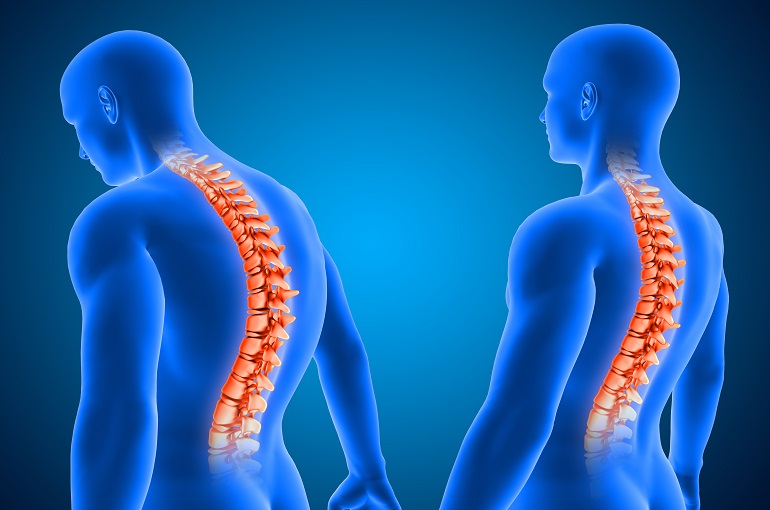 نقش پیلاتس در کاهش دردهای ستون فقرات- رکوردکالا